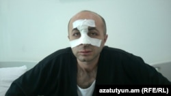 Armenia -- Hayk Khanumian, NK MP in hospital in Stepanakert. 07June, 2016