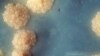 Колония бактерий Mycobacterium tuberculosis. Сегодня микроорганизмы стали одним из основных объектов исследования эволюции.