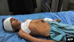 A wounded boy receives treatment at a hospital in Jalalabad after an explosion in the Ghani Khel district of Nangarhar province, which killed at least 14 people.
