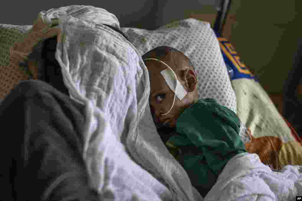 Un copil care suferă de malnutriție, lângă mama sa, în spitalul din Mekele, regiunea Tigray. (6 mai 2021) 