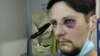 У Львові на двох ветеранів АТО напали поліцейські з Чернівців, Ковеля і Бережан