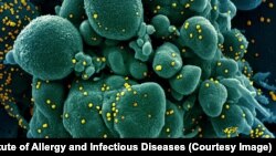 Imagine a unui țesut infectat cu coronavirus (în galben)