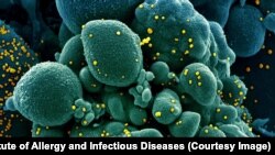 imagine la microscopul electronic cu coronavirus (în galben)