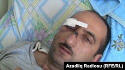 Azerbaijani journalist Idrak Abbasov recovers from his beating in a Baku hospital. 